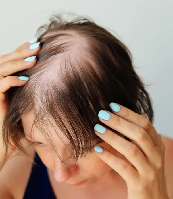 Close-up of skin affected by thinning hair & hair loss