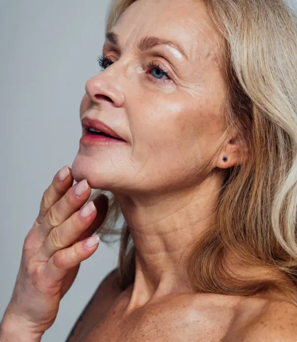 Close-up of skin affected by sagging skin / volume loss