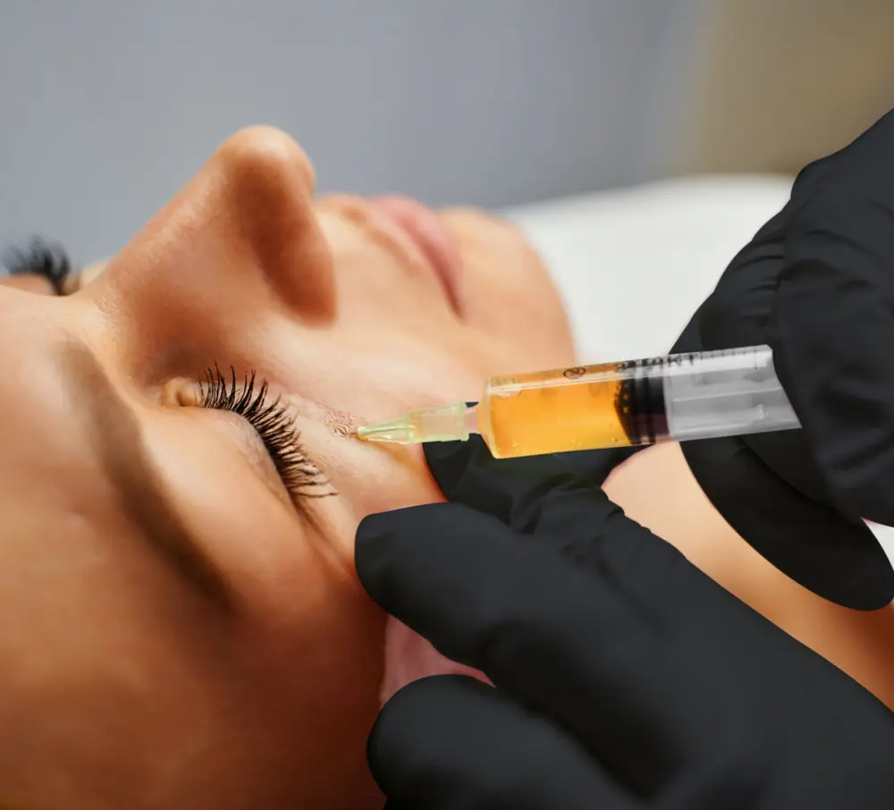 PRP Face Rejuvenation treatment at ELIIXA