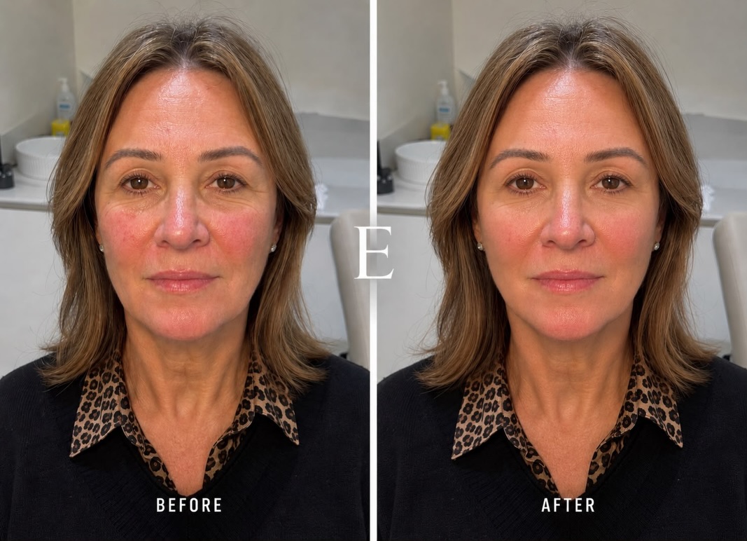 Facial balancing is about creating harmony, proportion and structure across the face; not changing what makes you unique