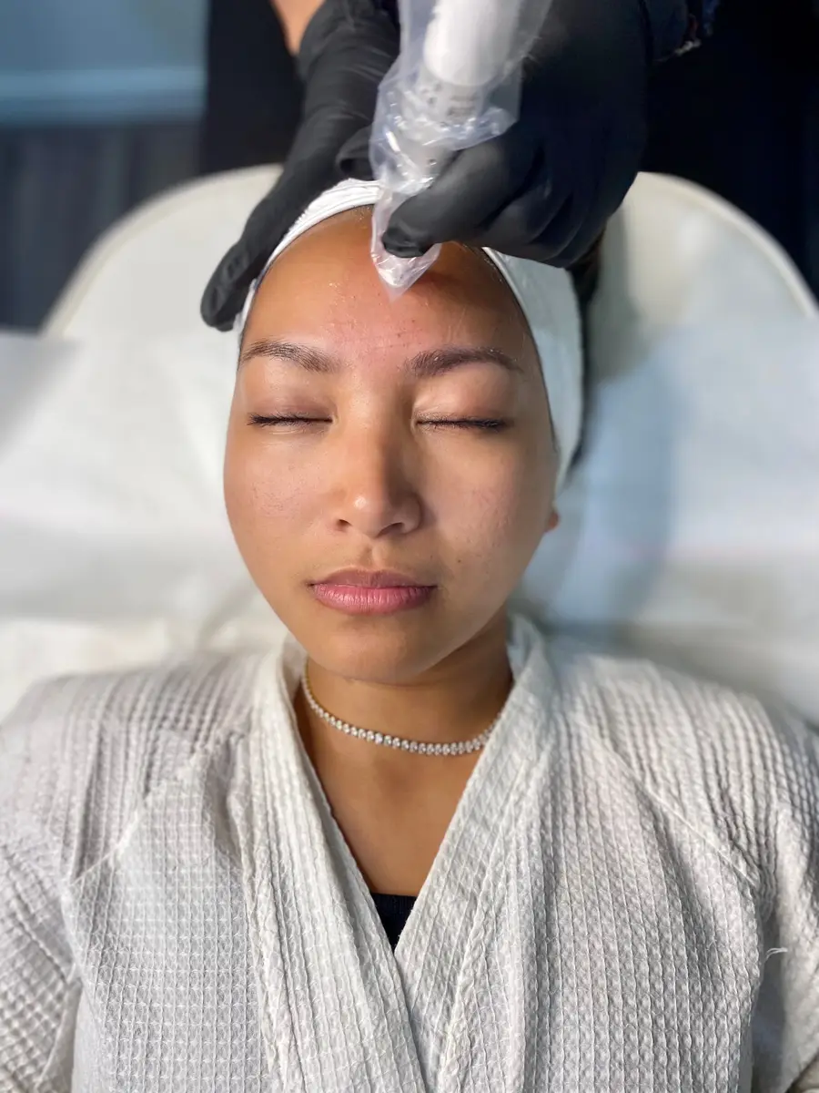 Dermapen Skin Needling at ELIIXA