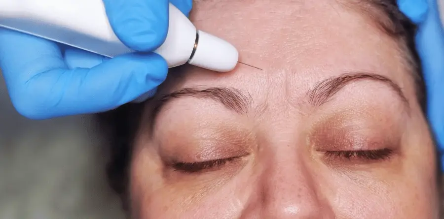 Fibroblast Plasma Pen at ELIIXA