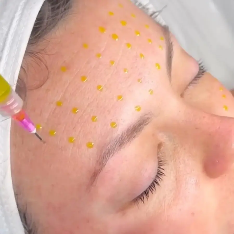 Clinical Skin Peels at ELIIXA